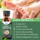 Fast Nail Fungal Treatments Nail Repair