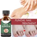 Fast Nail Fungal Treatments Nail Repair